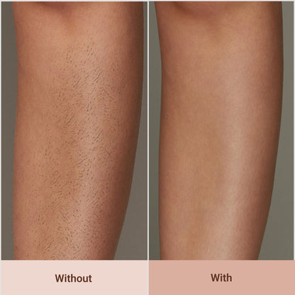 Lunn Store - IPL Hair Removal Epilator